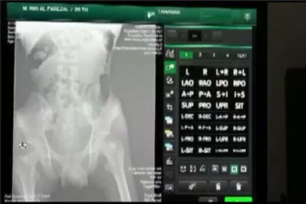 Sembunyikan Sabu 0,5 Kg di Dalam Anus, 2 Remaja Diringkus Polda NTB