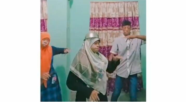 Viral Aksi 3Saudara Pengidap Sindrome Treacher Collin di Tik Tok, Ini Fakta Ilmiahnya