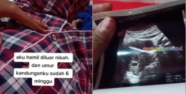 Viral Curhat Wanita Hamil di Luar Nikah, Pasangan Tak Tanggung Jawab