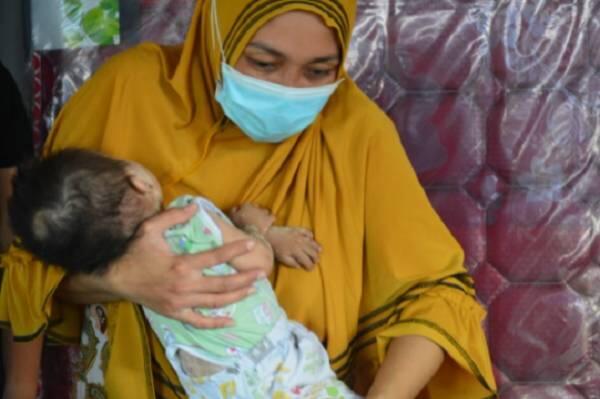 Pasca Operasi Down Sydnrome, Afiq Raanan Dibantu Persit Korem 143/HO