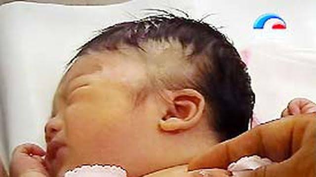 Pernah Melihat Fenomena Unik Puting Bayi Keluarkan Susu? Kenali Kondisi Galactorrhea