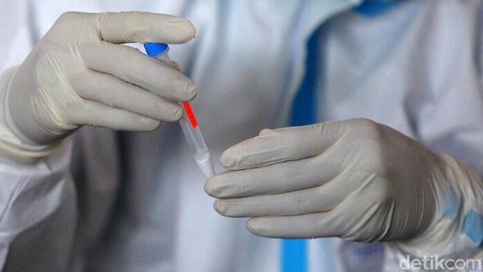 TKA China di Maluku Positif COVID-19 Hasil Tes Antigen, 19 Orang Terpapar