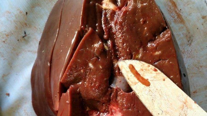 Fakta Bahaya Cacing Hati, Ini Dia Cara Membedakan Hati Sapi yang Sehat dan Tidak!