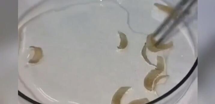 Ingin Tahu Sebanyak Apa Bakteri Dalam Kuku? Ini Dia Video Penampakan dan Bahayanya