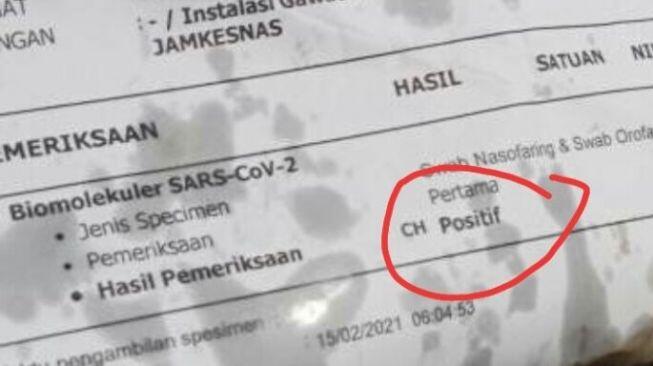 Ngeri-ngeri Sedap, Makan Gorengan Bungkusnya Bekas Hasil Tes COVID-19 Positif