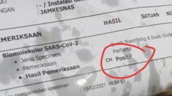 Bungkus Gorengan, Dari Kertas Hasil Swab/Pcr Positif Berbahaya Ga Ya?