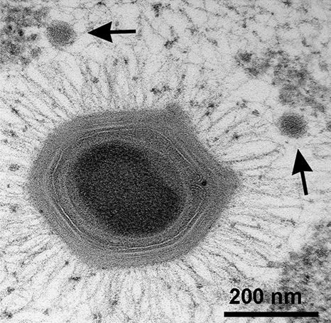 Virus Berukuran Raksasa Ditemukan Didalam Palung Mariana