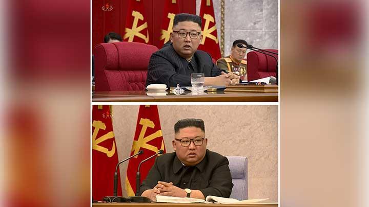 Kepala Kim Jong Un Ada Bintik Hijau dan Pakai Perban, Sakit Apa?