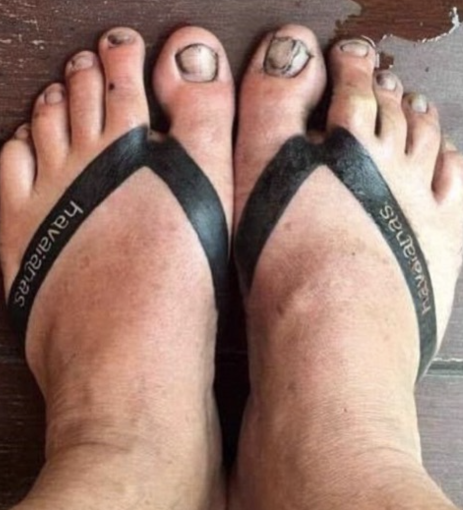 Tattoo Terjelek Di Dunia