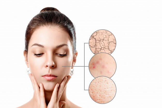 6 Cara Memilih Skincare untuk Pemula, JANGAN ASAL PAKE!