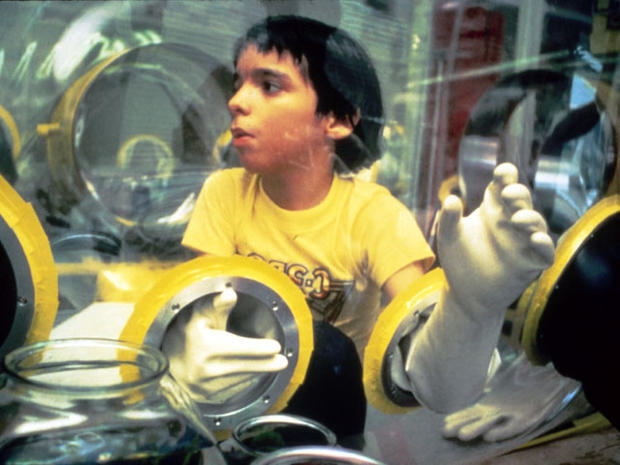 David Bubble Boy. Bocah yang Harus Hidup Dalam Gelembung Plastik Steril Seumur Hidup