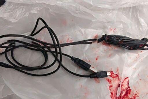 Miris, Pria ini Masukkan Kabel USB Kedalam Lubang Penisnya Buat Ngukur Panjangnya