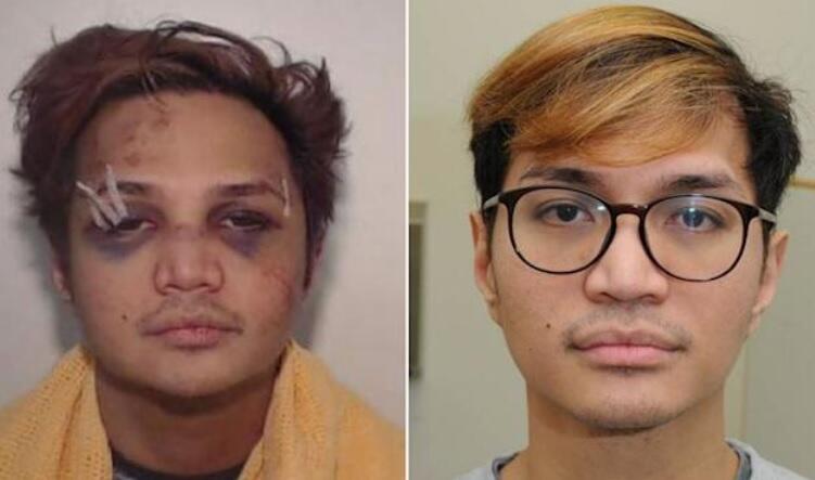 Wajah Predator Seksual Reinhard Sinaga Babak Belur