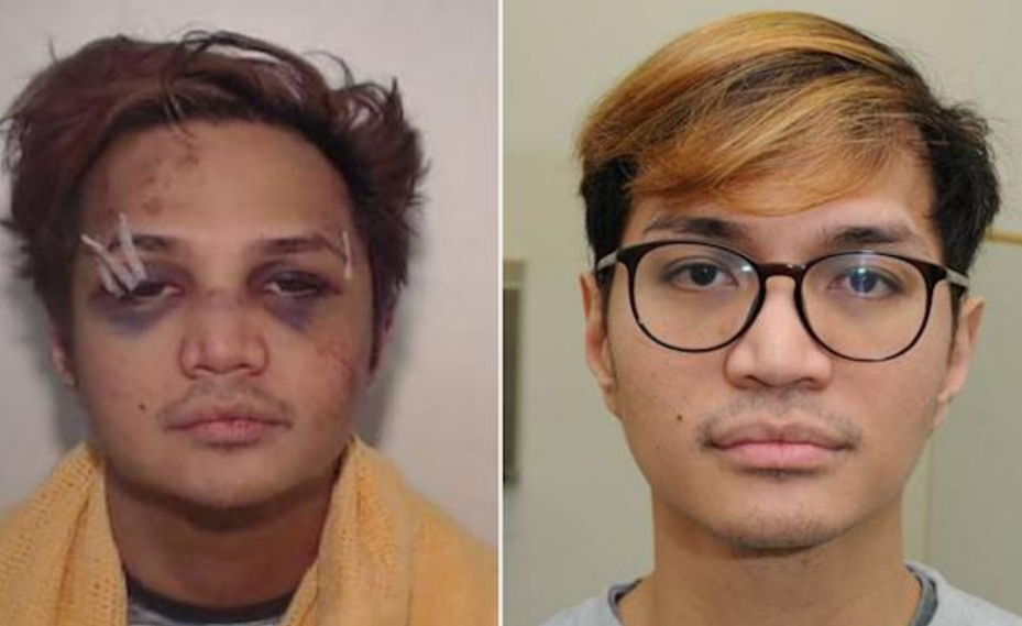 Tuman! Wajah Predator Seksual Reinhard Sinaga Babak Belur