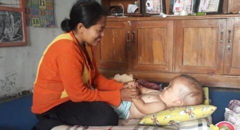 Miris! Kasal, Balita Hidrosefalus di Jember Ini Hanya Jalani Pengobatan Alternatif