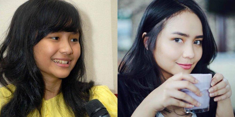 Bikin Melongo, 5 Artis Ini Dulu Warna Kulitnya Kusam Sekarang Jadi Putih Kinclong!