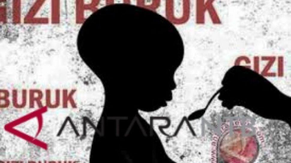 Di Simeulue Ada 12 Anak Alami Gizi Buruk