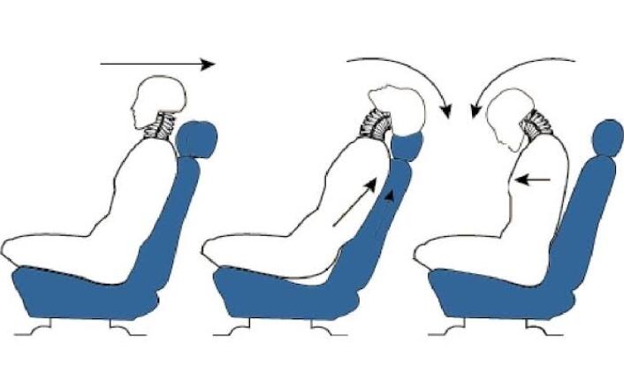 Inilah 3 Fungsi Headrest Mobil yang Jarang Orang Tahu! (Yu, Di Baca Yuk!)