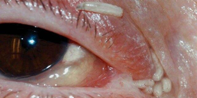 Bukan Belatung, Tapi Cacing Kremi Yang Bisa Berada Di Vagina!