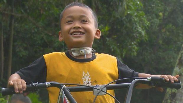 Cerita Sedih Rafli Tak Lagi Sekolah Usai Leher Bolong Gegara Ditendang Sapi
