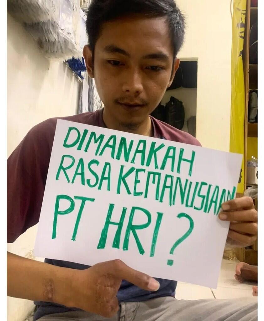 Setelah Jari Putus 4 Malah di PHK PT HRI, Pengakuan Karyawan Ini Viral