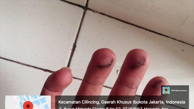 Ngeri! Korban Pencemaran Debu Batu Bara di Marunda, Anak-anak dan Orang Tua Kena