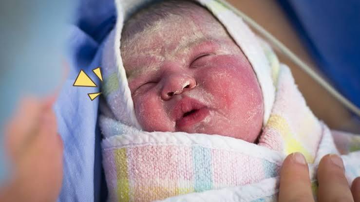 Bayi Berselimut Lemak Saat Habis Lahir? Jangan Salahkan Ibunya, Pahami Vernix Caseosa