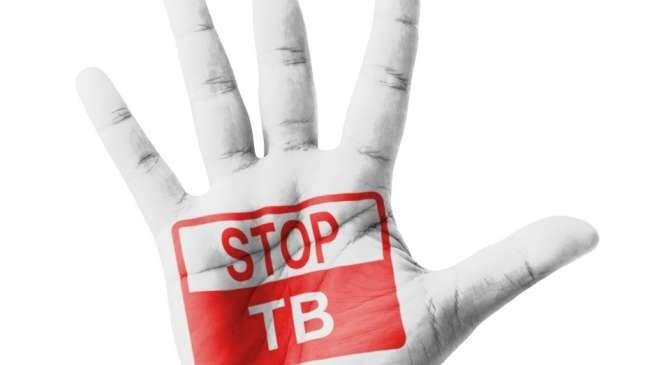 24 Maret, Hari Tuberkulosis Sedunia