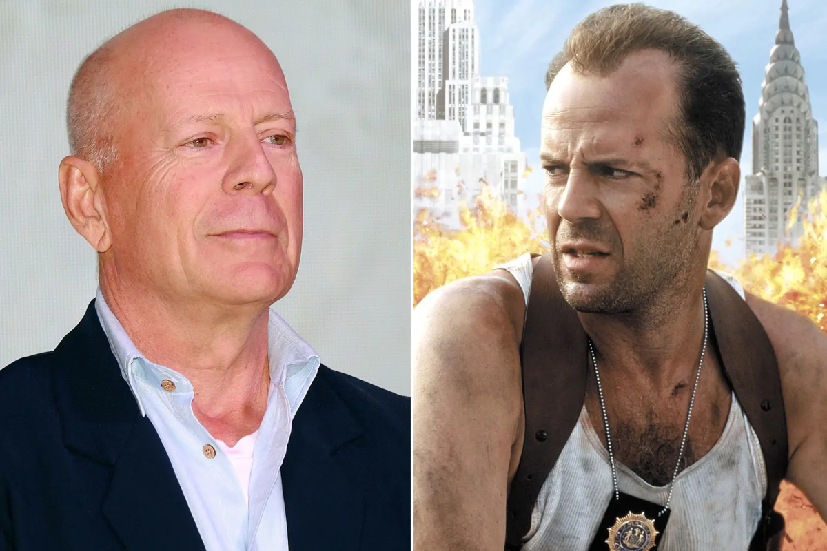 Apa Itu Aphasia Yang Diderita Oleh Bruce Willis?