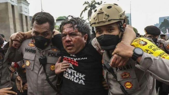 Dosen UGM Diduga Komentari Pemukulan Ade Armando, Pihak Kampus Tindak Lanjut