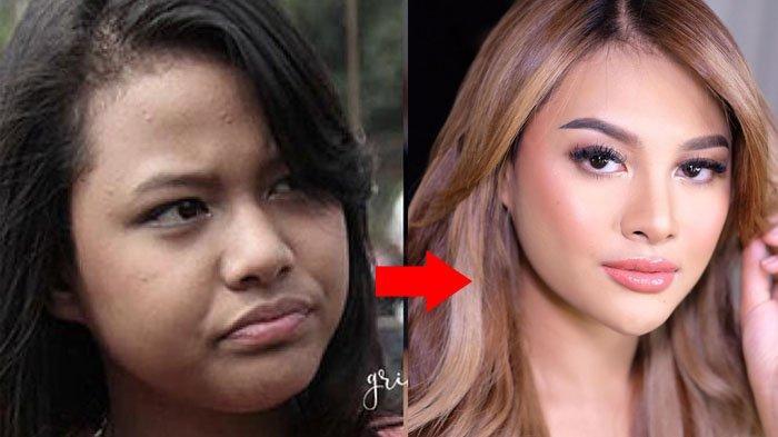 Aurel Hermansyah Jadi Korban Body Shaming Netizen, Orang Terdekat Jadi Sosok Penguat