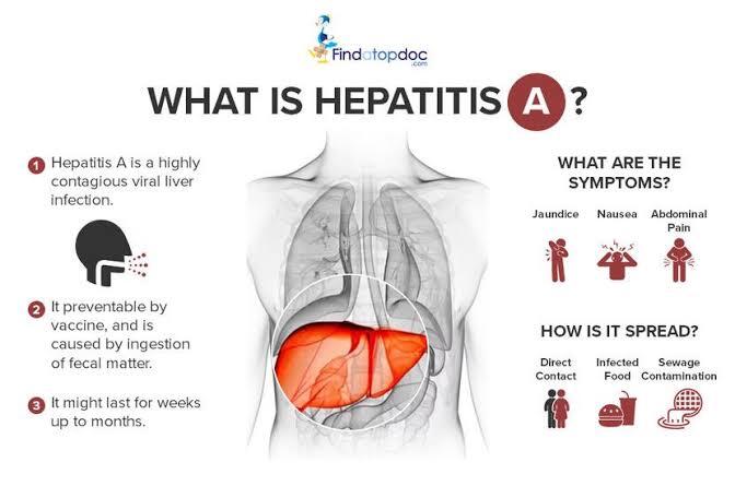 Waspada Kenali Sistem Penularan Hepatitis A B C D E Bahaya Superinfeksi Nya IndoForum