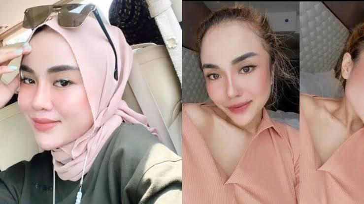 Terlibat Penipuan Terhadap Artis, Medina Zein Diduga Alami Bipolar Disorder, Apa Itu?