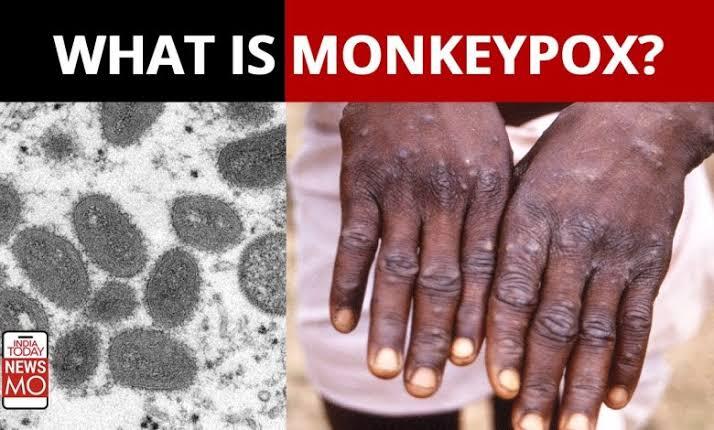 Virus Monyet atau Monkeypox Kini Hantui Kesehatan Dunia
