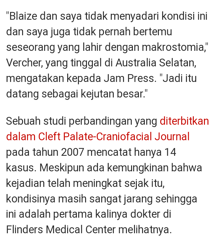 Bayi Lahir dengan Senyum Lebar, Apakah Terlihat Seperti Tokoh Joker?