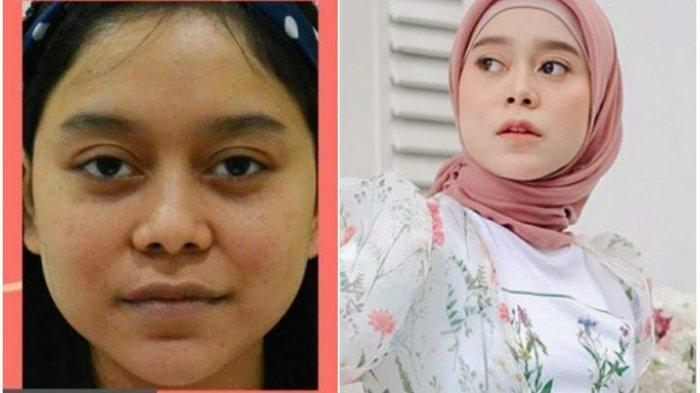 5 Artis Wanita yang Menurut Ane Sukses Rombak Wajah, 180 Drajat Bikin Pangling!