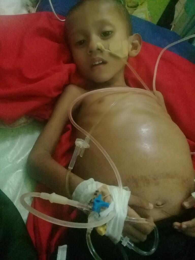 Donasi untuk penyakit Tumor Wilm's Kanan - Anakberusia