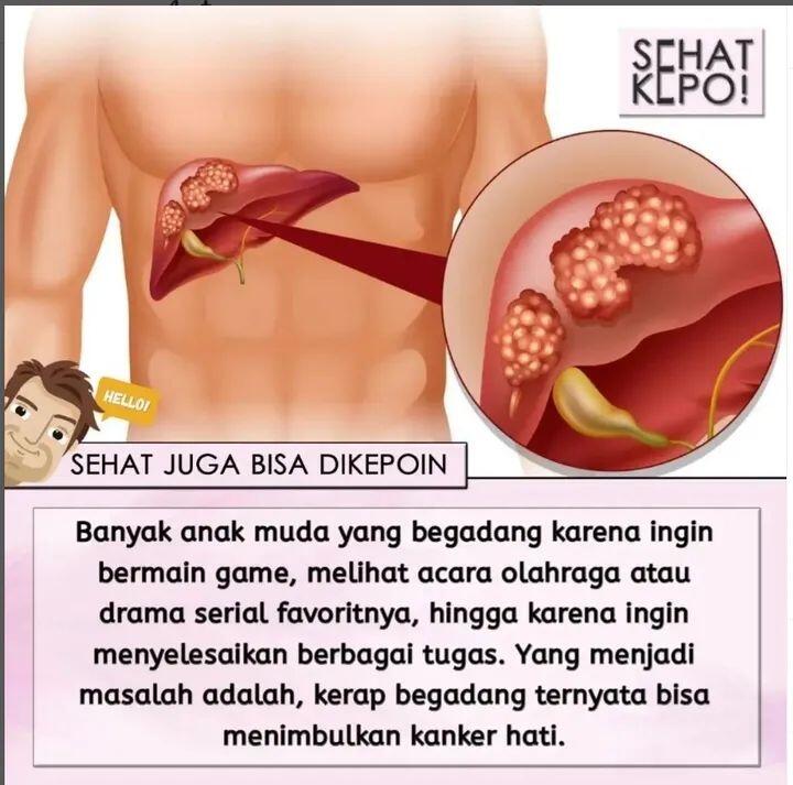 Sirosis, Awal Penyakit Kanker Hati yang Kini Marak Terjadi, Ada Solusi? Sharing Yuk!