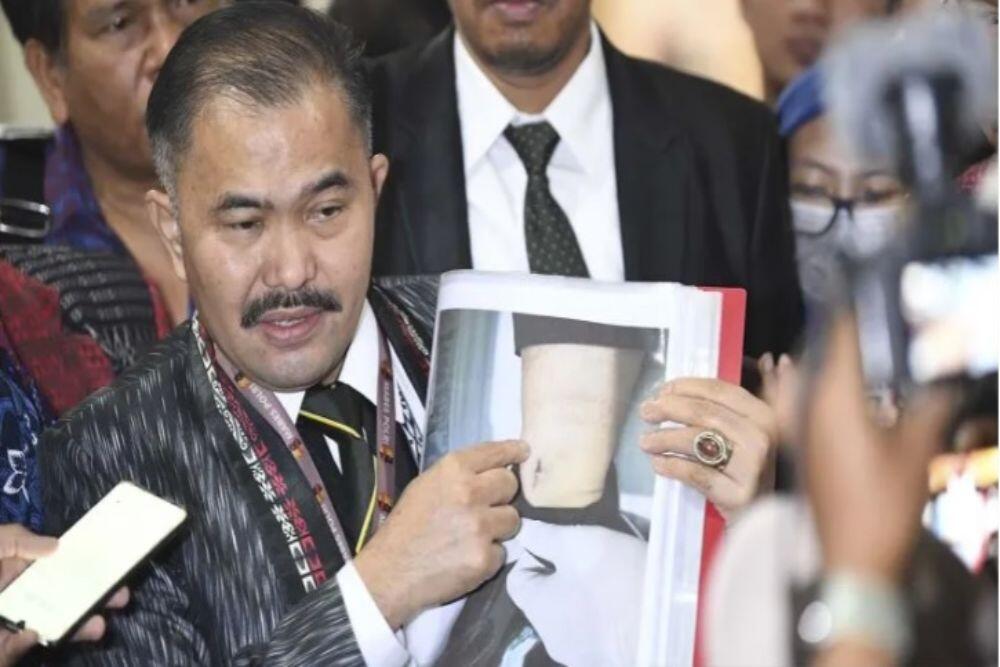 Keluarga: Leher Brigadir J Dililit, Sayatan di Tubuh dan Kuku Kaki Dicabut