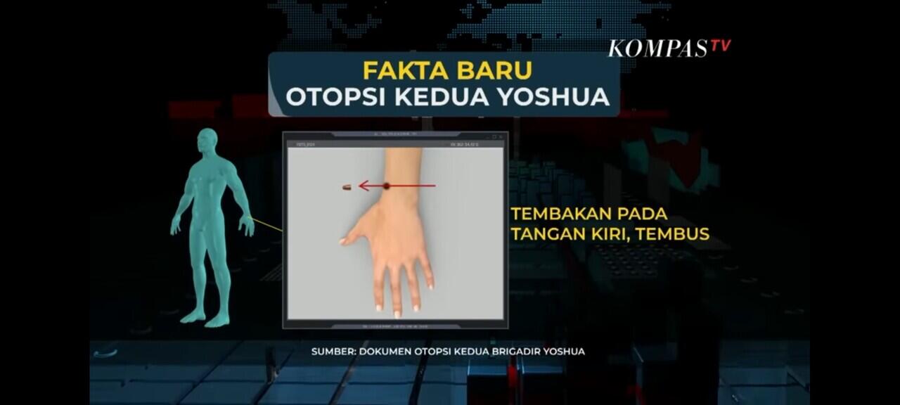 Fakta Terbaru dari Otopsi Kedua Jenazah Brigadir Joshua