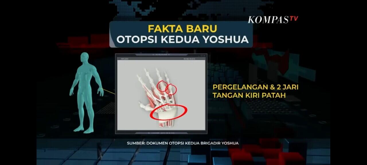 Fakta Terbaru dari Otopsi Kedua Jenazah Brigadir Joshua