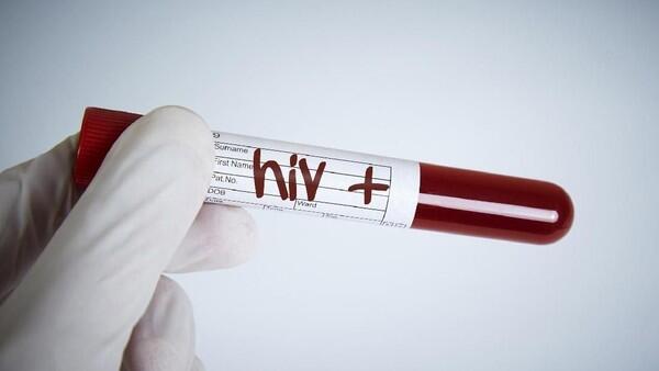 10 Provinsi di RI dengan Kasus HIV Terbanyak, DKI Nyaris 100 Ribu
