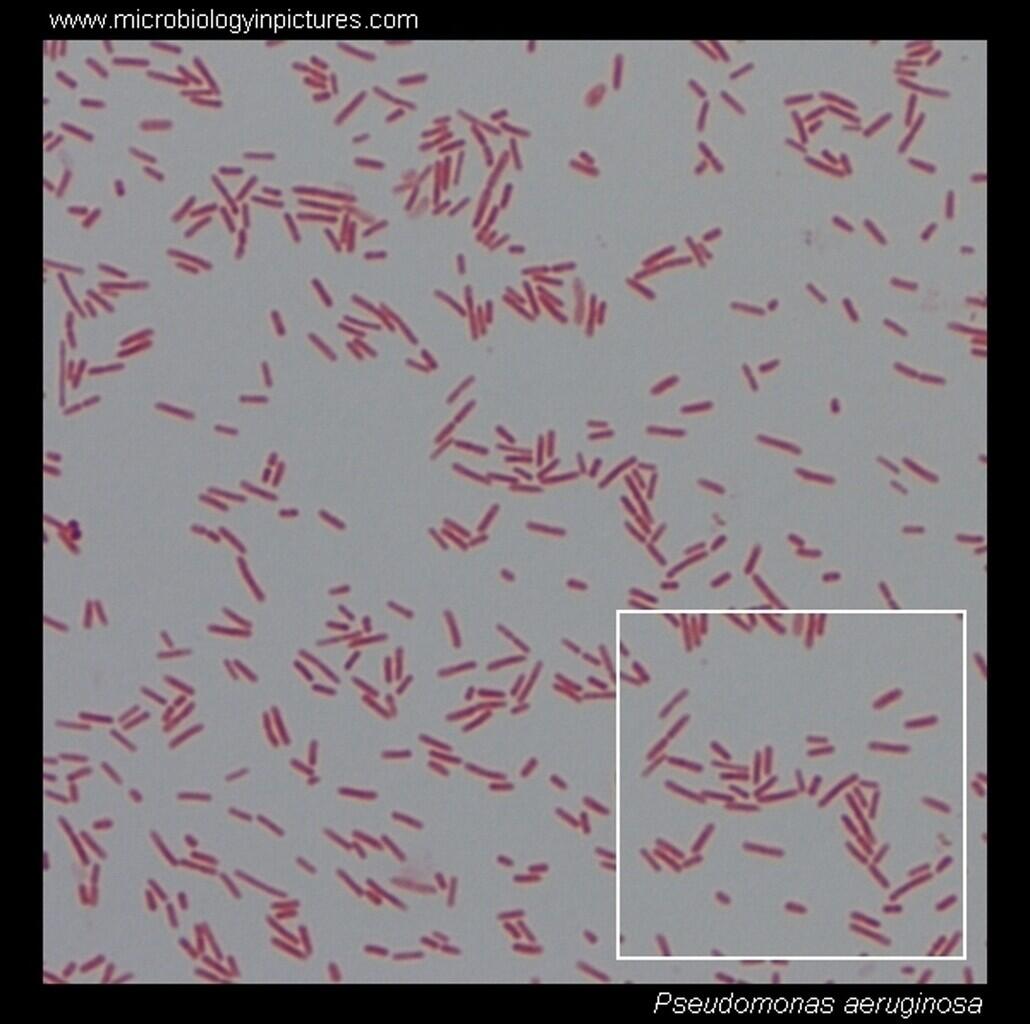 Pseudomonas spp. Pseudomonas putida под микроскопом. Pseudomonas aeruginosa микроскопия. Pseudomonas aeruginosa мазок. Синегнойная палочка PS. Aeruginosa.