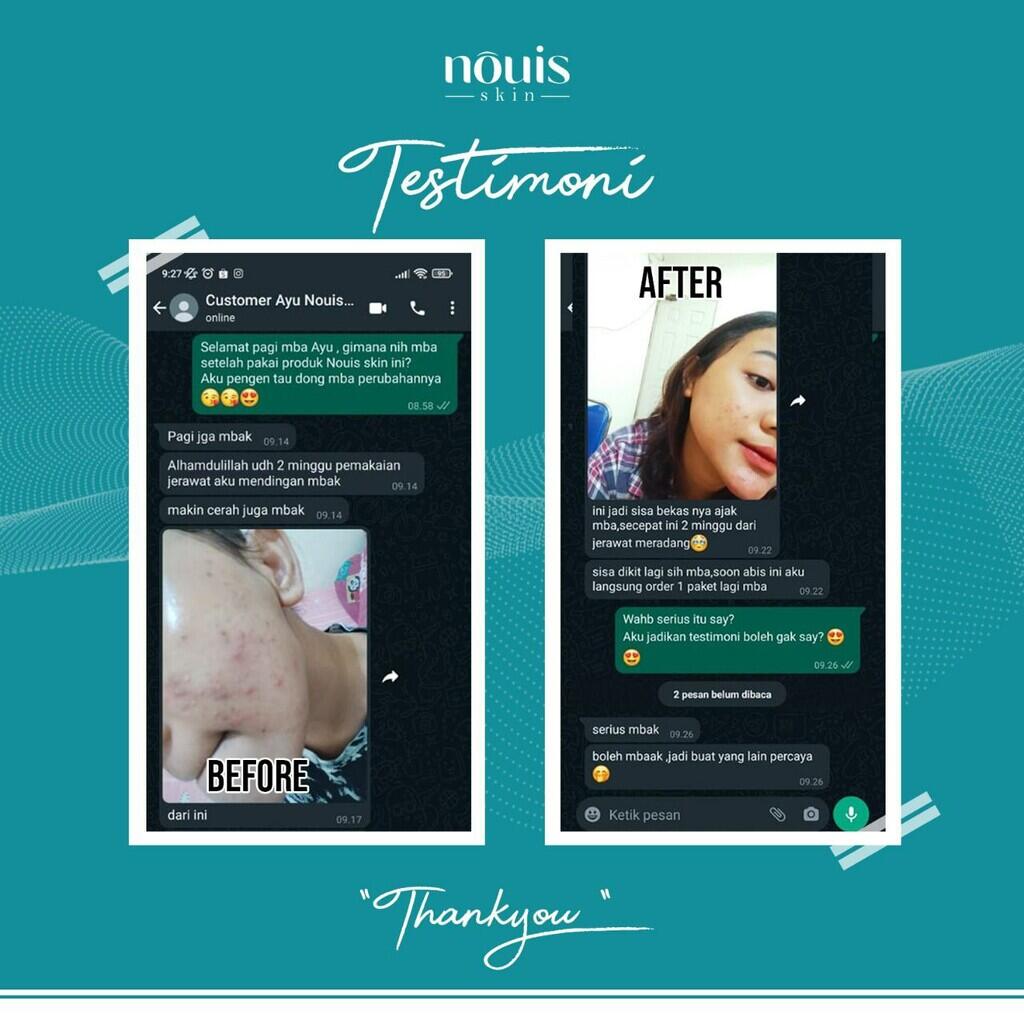 Penawaran Jadi Marketer Nouis Skincare Tanpa Syarat