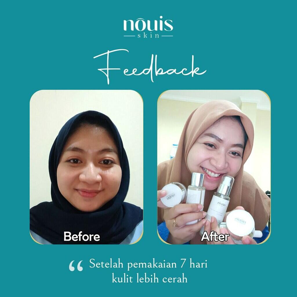 Penawaran Jadi Marketer Nouis Skincare Tanpa Syarat