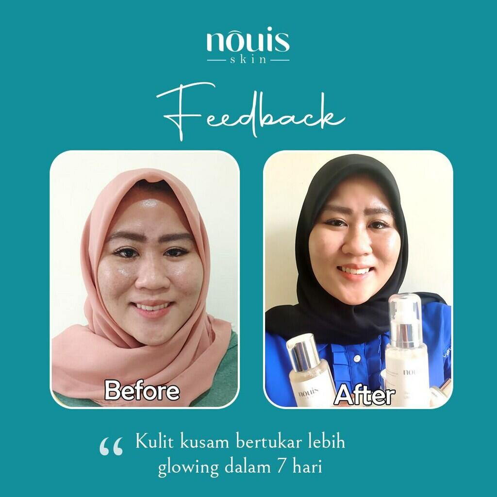 Penawaran Jadi Marketer Nouis Skincare Tanpa Syarat