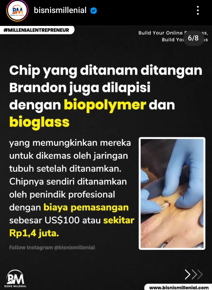 Tanam Chip di Tangan dengan Teknologi NFC Apakah Solusi Bagi Si Pelupa, Tidak Ngeri?