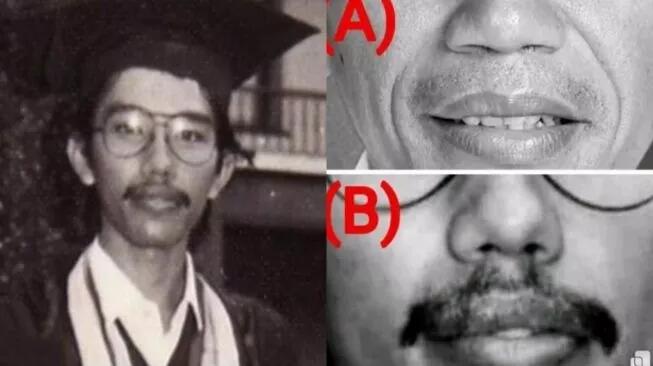 Dokter Tifa Tuding Foto Saat Jokowi Wisuda Tak Mirip Secara Ilmu Anatomi..