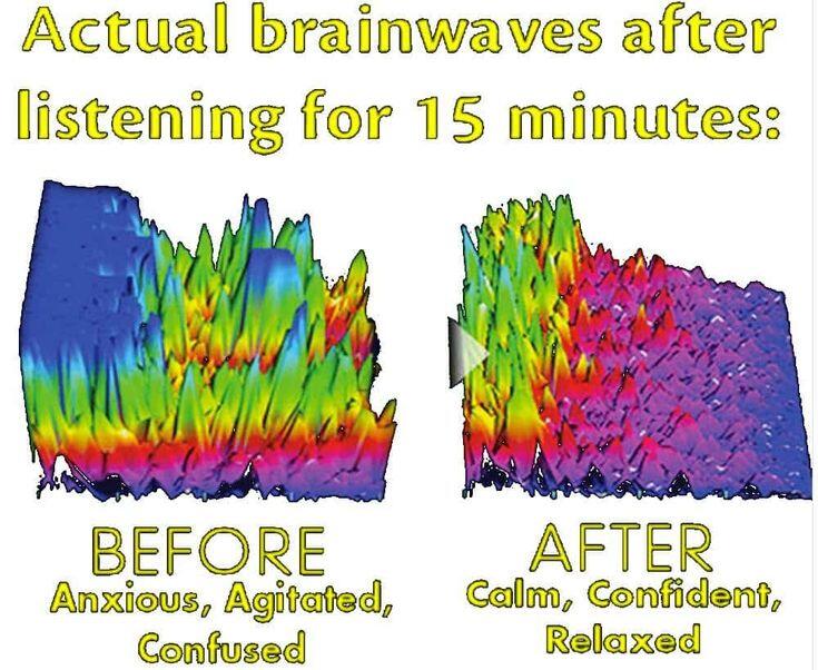 gambar kondisi otak setelah diterapi binaural