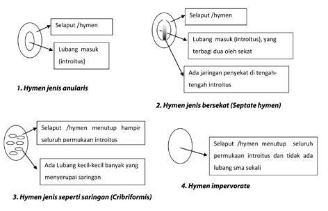 Baru Tahu! Begini Cara Cek Keperawanan Loh GanSis...